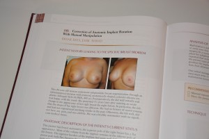 breast-augmentation-textbook