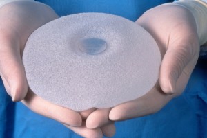 breast implants linked to rare cancer